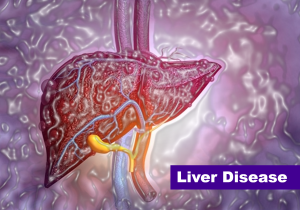 Introduction to Liver Disease
